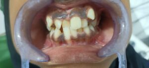 Shaji Dental Hospital (5)