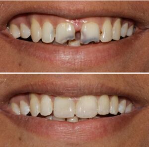 Smile Craft Advanced Dental Care (5)