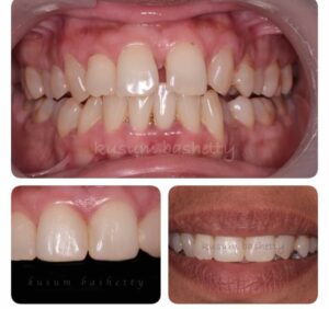 Smile Craft Advanced Dental Care (6)