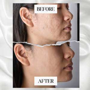 Facial and Skin Treatment (2)