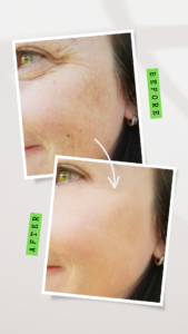 Facial and Skin Treatment (5)