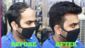 Hair wigs, Extension,patchs (3)